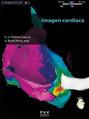 cover image of Imagen cardiaca